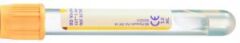 BD 367955 Vacutainer® Serum Separatör Tüpler® 100lük paket